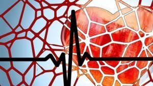 Vernauwing in ader door cholesterol-ophoping
